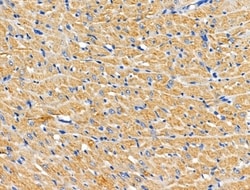 Invitrogen CHSY1 Polyclonal Antibody 100 &mu;L; Unconjugated:Antibodies,