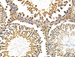 Invitrogen CHSY1 Polyclonal Antibody 100 &mu;L; Unconjugated:Antibodies,