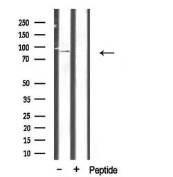 Invitrogen CHSY1 Polyclonal Antibody 100 &mu;L; Unconjugated:Antibodies,