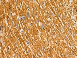 Invitrogen CMTM2 Polyclonal Antibody 100 &mu;L; Unconjugated:Antibodies,