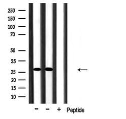 Invitrogen CMTM2 Polyclonal Antibody 100 &mu;L; Unconjugated:Antibodies,