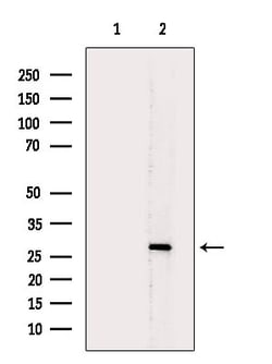 Invitrogen CMTM2 Polyclonal Antibody 100 &mu;L; Unconjugated:Antibodies,