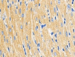 Invitrogen C1QC Polyclonal Antibody 100 &mu;L; Unconjugated:Antibodies,