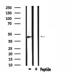 Invitrogen ATG4C Polyclonal Antibody 100 μL; Unconjugated:Antibodies,