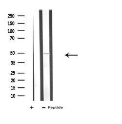Invitrogen ATG4C Polyclonal Antibody 100 μL; Unconjugated:Antibodies,