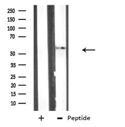 Invitrogen ATG4D Polyclonal Antibody 100 μL; Unconjugated:Antibodies,