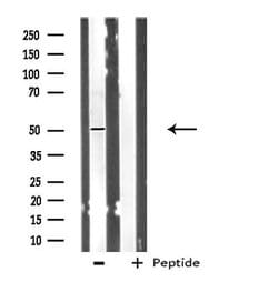 POLD3 Polyclonal Antibody:Antibodies, Polyclonal
