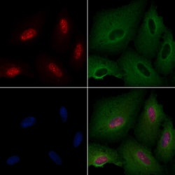 Invitrogen POLR1B Polyclonal Antibody 100 &mu;L; Unconjugated:Antibodies,