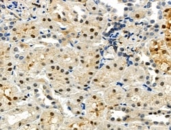 Invitrogen POLR1B Polyclonal Antibody 100 &mu;L; Unconjugated:Antibodies,