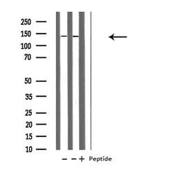 Invitrogen POLR1B Polyclonal Antibody 100 &mu;L; Unconjugated:Antibodies,