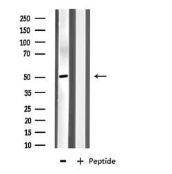 Invitrogen MYLIP Polyclonal Antibody 100 &mu;L; Unconjugated:Antibodies,