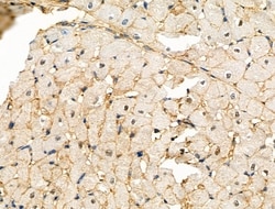 Invitrogen RFWD2 Polyclonal Antibody 100 &mu;L | Buy Online | Invitrogen&trade; | Fisher Scientific