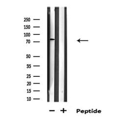 Invitrogen RFWD2 Polyclonal Antibody 100 &mu;L | Buy Online | Invitrogen&trade; | Fisher Scientific