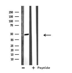 Invitrogen EFEMP2 Polyclonal Antibody 100 &mu;L; Unconjugated:Antibodies,