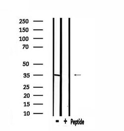 Invitrogen ELOVL6 Polyclonal Antibody 100 μL; Unconjugated:Antibodies,