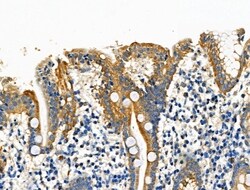 Invitrogen eIF5B Polyclonal Antibody 100 &mu;L; Unconjugated:Antibodies,