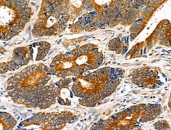 Invitrogen eIF5B Polyclonal Antibody 100 &mu;L; Unconjugated:Antibodies,