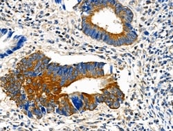 Invitrogen eIF5B Polyclonal Antibody 100 &mu;L; Unconjugated:Antibodies,