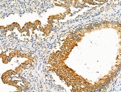 Invitrogen eIF5B Polyclonal Antibody 100 &mu;L; Unconjugated:Antibodies,