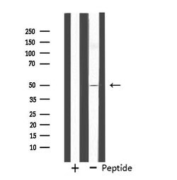 Invitrogen FOXN4 Polyclonal Antibody 100 &mu;L; Unconjugated:Antibodies,