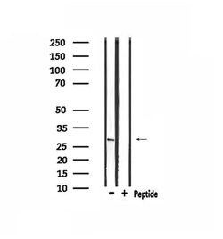 Invitrogen MSX2 Polyclonal Antibody 100 &mu;L; Unconjugated:Antibodies,