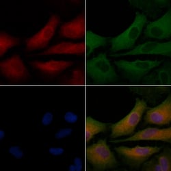 Invitrogen MGST2 Polyclonal Antibody 100 &mu;L; Unconjugated:Antibodies,