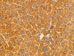 Invitrogen MGST2 Polyclonal Antibody 100 &mu;L; Unconjugated:Antibodies,