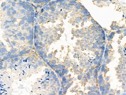 Invitrogen MGST2 Polyclonal Antibody 100 &mu;L; Unconjugated:Antibodies,