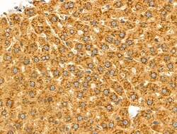 Invitrogen MGST2 Polyclonal Antibody 100 &mu;L; Unconjugated:Antibodies,