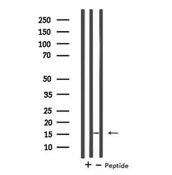 Invitrogen MGST2 Polyclonal Antibody 100 &mu;L; Unconjugated:Antibodies,