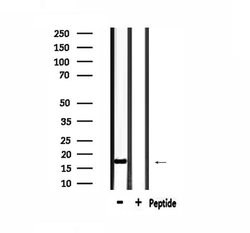 Invitrogen MGST2 Polyclonal Antibody 100 &mu;L; Unconjugated:Antibodies,