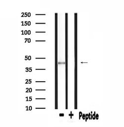 Invitrogen SLC16A13 Polyclonal Antibody 100 &mu;L; Unconjugated:Antibodies,