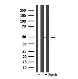 Invitrogen SLC16A3 Polyclonal Antibody 100 μL; Unconjugated:Antibodies,