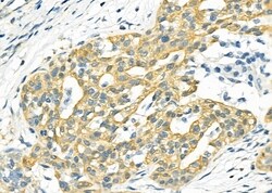 Invitrogen NDUFA4L2 Polyclonal Antibody 100 &mu;L; Unconjugated:Antibodies,