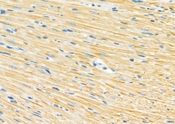 Invitrogen NDUFA4L2 Polyclonal Antibody 100 &mu;L; Unconjugated:Antibodies,