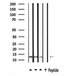 Invitrogen NDUFA4L2 Polyclonal Antibody 100 &mu;L; Unconjugated:Antibodies,