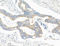 Invitrogen NDUFV2 Polyclonal Antibody 100 &mu;L; Unconjugated:Antibodies,