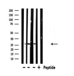 Invitrogen NDUFV2 Polyclonal Antibody 100 &mu;L; Unconjugated:Antibodies,