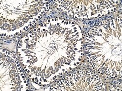 Invitrogen NBPF7 Polyclonal Antibody 100 &mu;L; Unconjugated:Antibodies,