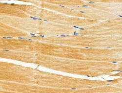 Invitrogen Neurocan Polyclonal Antibody 100 &mu;L | Buy Online | Invitrogen&trade; | Fisher Scientific