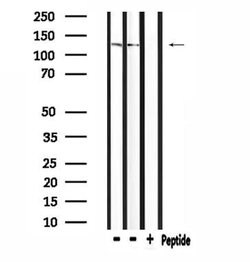 Invitrogen Neurocan Polyclonal Antibody 100 &mu;L | Buy Online | Invitrogen&trade; | Fisher Scientific