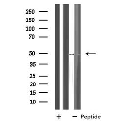 Invitrogen NLE1 Polyclonal Antibody 100 &mu;L | Buy Online | Invitrogen&trade; | Fisher Scientific