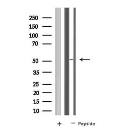 Invitrogen NARFL Polyclonal Antibody 100 &mu;L; Unconjugated:Antibodies,