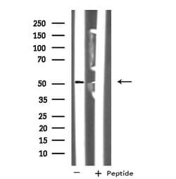 Invitrogen NUSAP1 Polyclonal Antibody 100 &mu;L; Unconjugated:Antibodies,