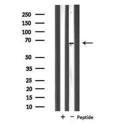 Invitrogen NOLC1 Polyclonal Antibody 100 μL; Unconjugated:Antibodies,