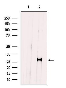Invitrogen PRRX1 Polyclonal Antibody 100 &mu;L; Unconjugated:Antibodies,