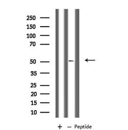 Invitrogen PLD4 Polyclonal Antibody 100 &mu;L; Unconjugated:Antibodies,