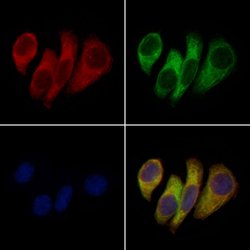 Invitrogen KCNK6 Polyclonal Antibody 100 μL; Unconjugated:Antibodies,