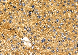 Invitrogen KCNK6 Polyclonal Antibody 100 μL; Unconjugated:Antibodies,