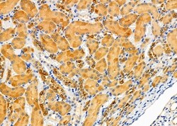 Invitrogen KCNK6 Polyclonal Antibody 100 μL; Unconjugated:Antibodies,